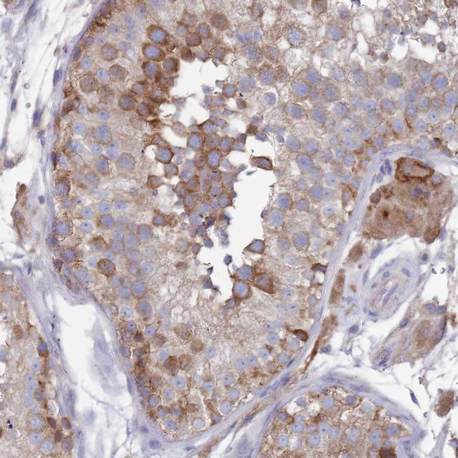 SCAPER Antibody in Immunohistochemistry (Paraffin) (IHC (P))