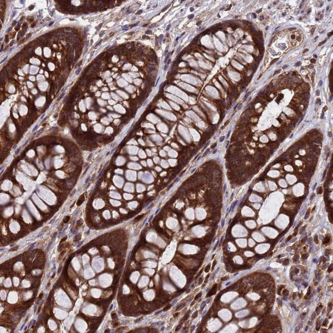 TSR3 Antibody in Immunohistochemistry (Paraffin) (IHC (P))