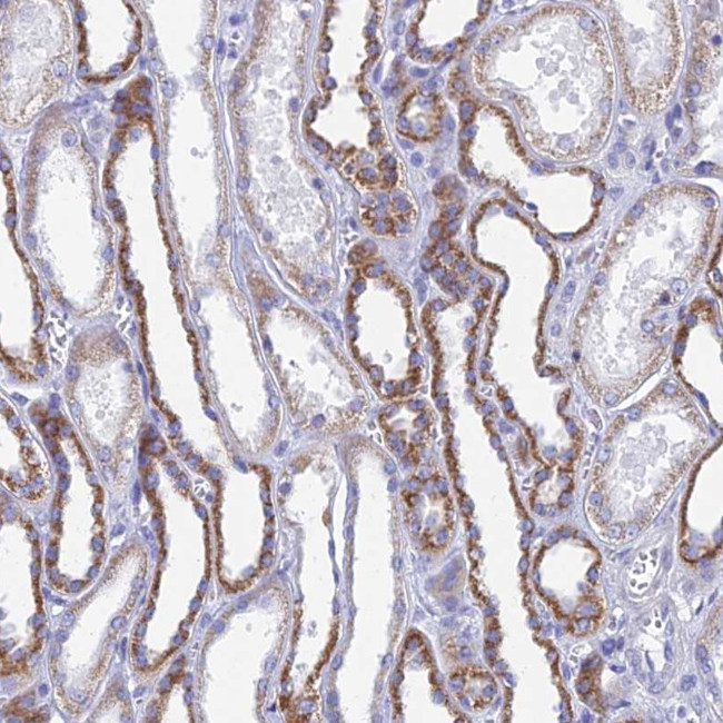 ACSM1 Antibody in Immunohistochemistry (Paraffin) (IHC (P))