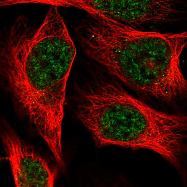 C19orf47 Antibody in Immunocytochemistry (ICC/IF)