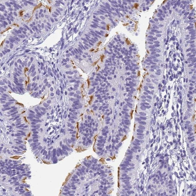 CCDC37 Antibody in Immunohistochemistry (IHC)