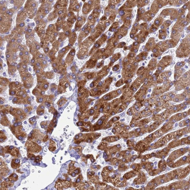 KNCN Antibody in Immunohistochemistry (Paraffin) (IHC (P))