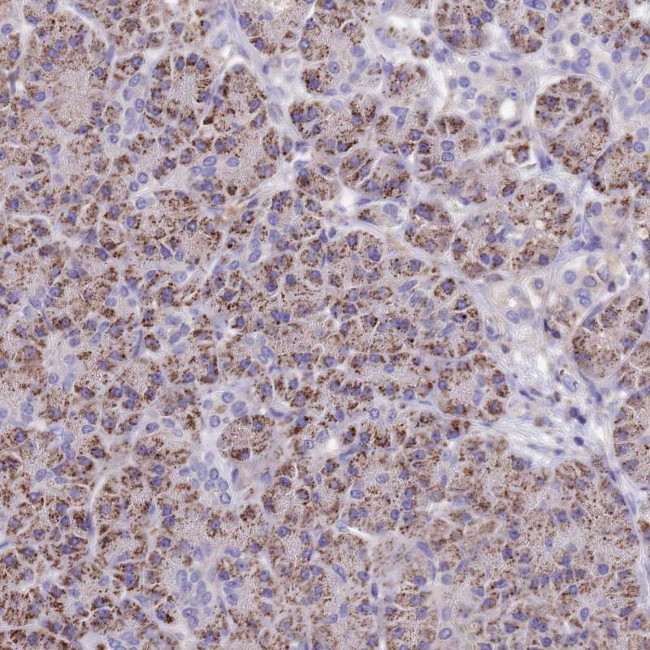 C3orf75 Antibody in Immunohistochemistry (Paraffin) (IHC (P))