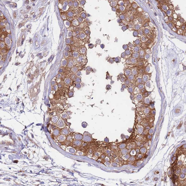 DDX19B Antibody in Immunohistochemistry (Paraffin) (IHC (P))