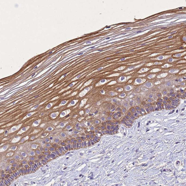 NALP11 Antibody in Immunohistochemistry (Paraffin) (IHC (P))