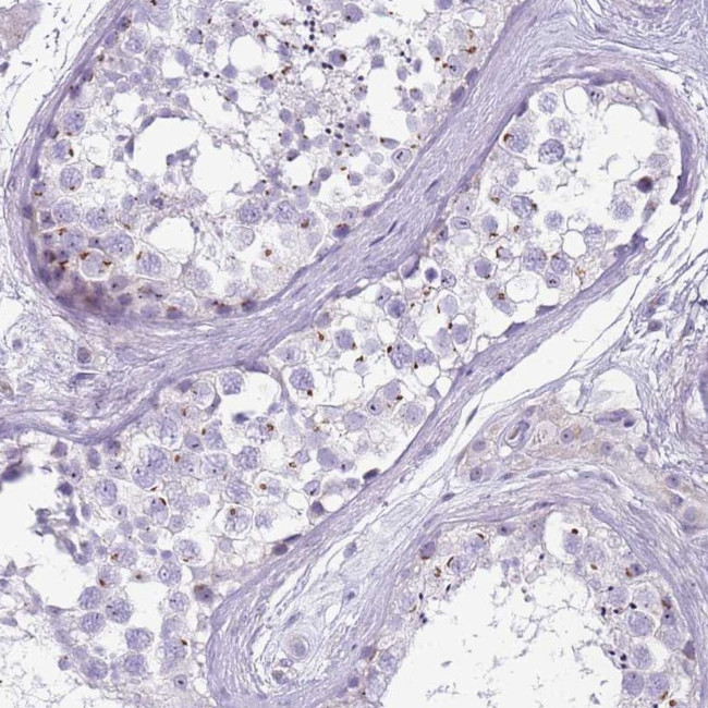 NBPF4 Antibody in Immunohistochemistry (Paraffin) (IHC (P))