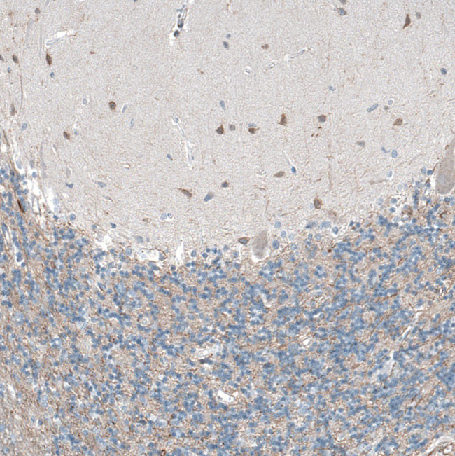 Oncomodulin Antibody in Immunohistochemistry (Paraffin) (IHC (P))
