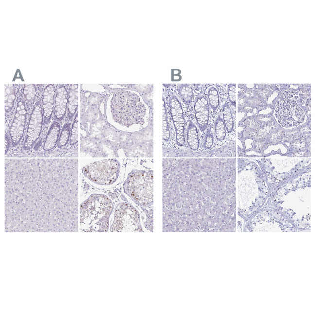 LUZP4 Antibody in Immunohistochemistry (IHC)