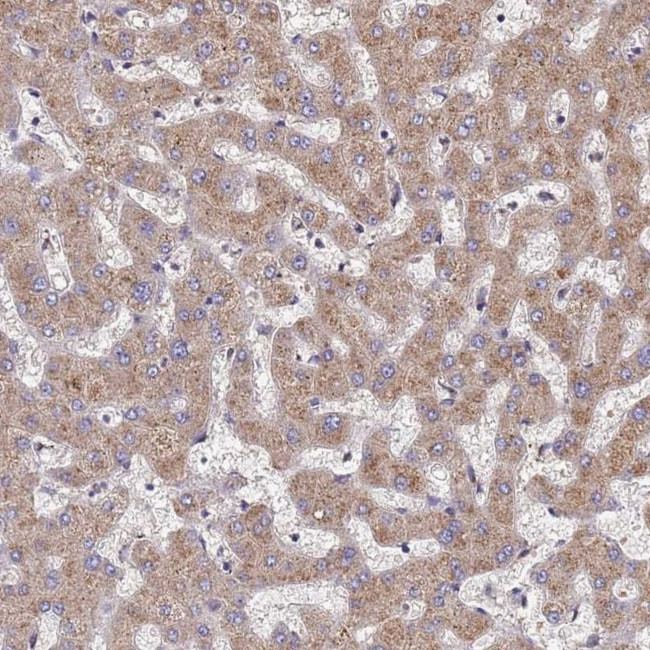 DPH5 Antibody in Immunohistochemistry (IHC)