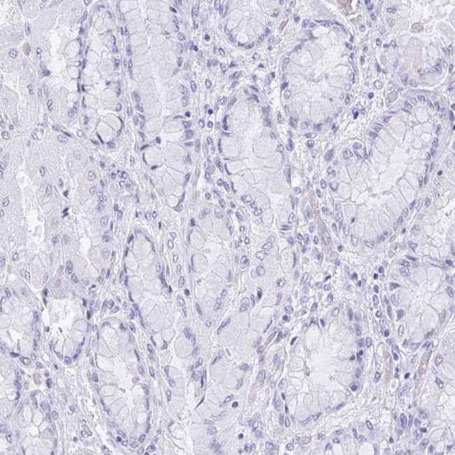 REG4 Antibody in Immunohistochemistry (Paraffin) (IHC (P))