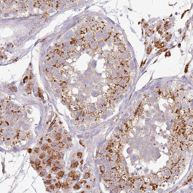 TMEM229B Antibody in Immunohistochemistry (Paraffin) (IHC (P))