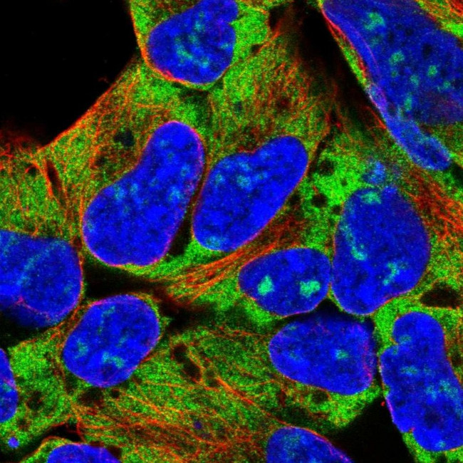 RPL18 Antibody in Immunocytochemistry (ICC/IF)