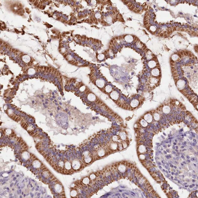 Calpain 7 Antibody in Immunohistochemistry (Paraffin) (IHC (P))