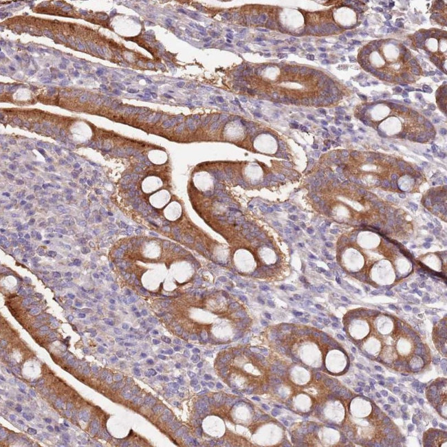 RQCD1 Antibody in Immunohistochemistry (Paraffin) (IHC (P))