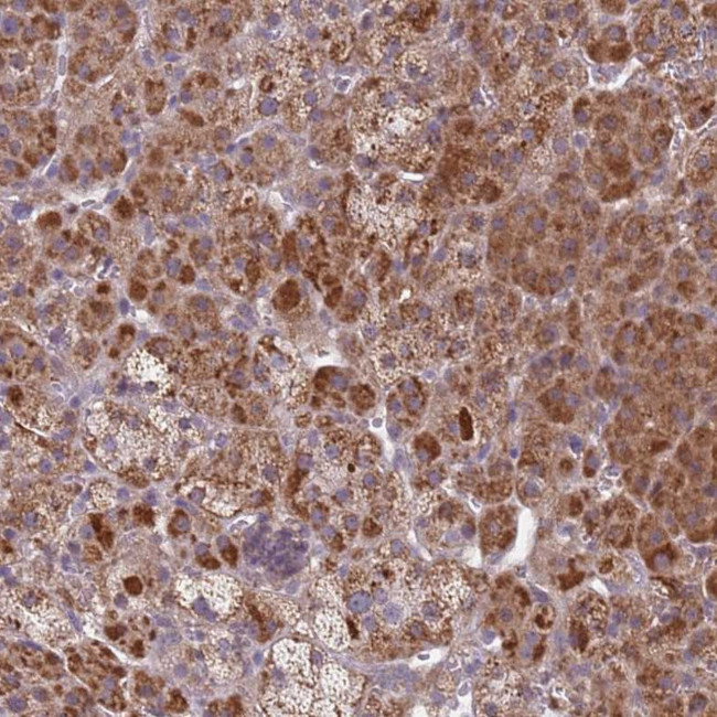 SNAPC4 Antibody in Immunohistochemistry (Paraffin) (IHC (P))