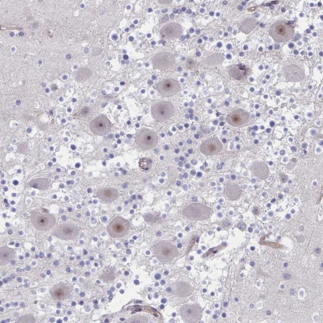 CENPQ Antibody in Immunohistochemistry (Paraffin) (IHC (P))