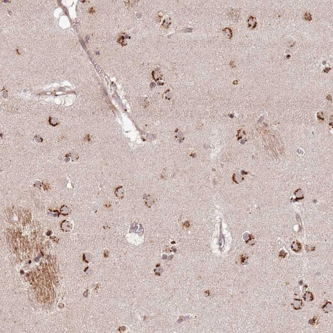 AF165138.7 Antibody in Immunohistochemistry (Paraffin) (IHC (P))