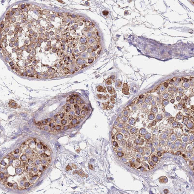 T126A Antibody in Immunohistochemistry (Paraffin) (IHC (P))