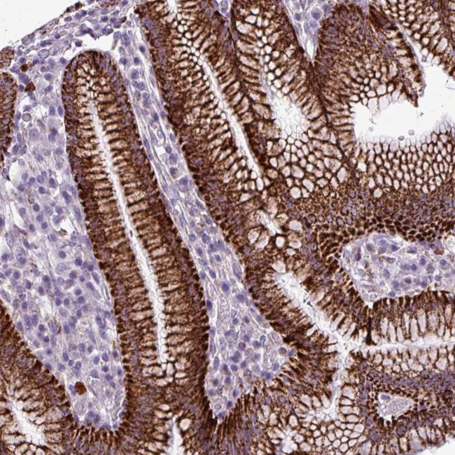 ZNF667 Antibody in Immunohistochemistry (Paraffin) (IHC (P))