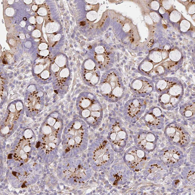 ATP8B2 Antibody in Immunohistochemistry (Paraffin) (IHC (P))
