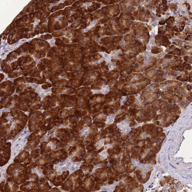 FAM153B Antibody in Immunohistochemistry (Paraffin) (IHC (P))