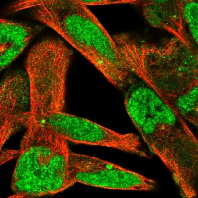 ZNF322A Antibody in Immunocytochemistry (ICC/IF)