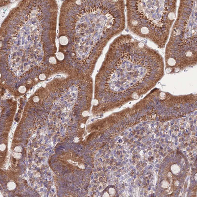 BOLA2 Antibody in Immunohistochemistry (Paraffin) (IHC (P))