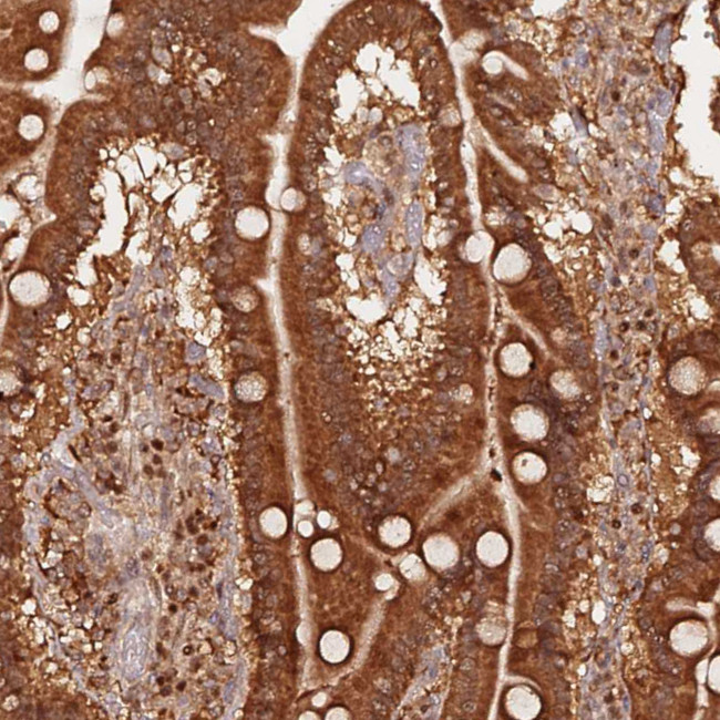 OR5V1 Antibody in Immunohistochemistry (Paraffin) (IHC (P))