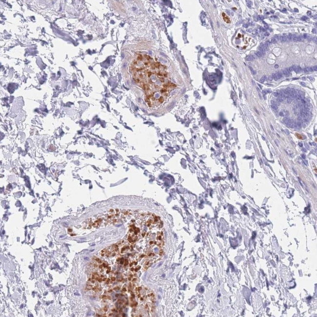 OR5D16 Antibody in Immunohistochemistry (Paraffin) (IHC (P))