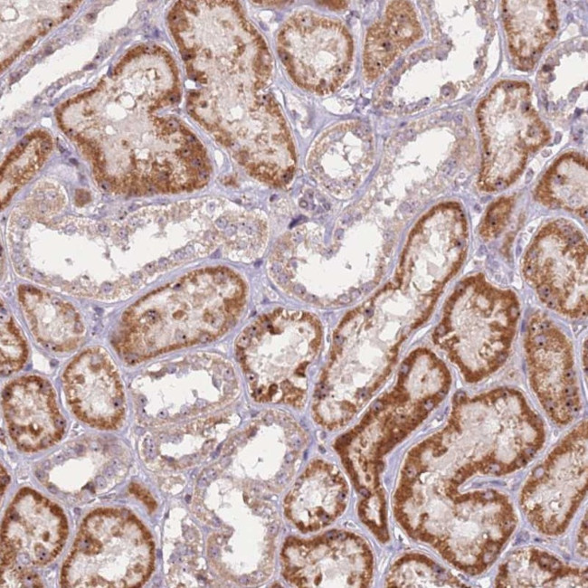 UCMA Antibody in Immunohistochemistry (Paraffin) (IHC (P))
