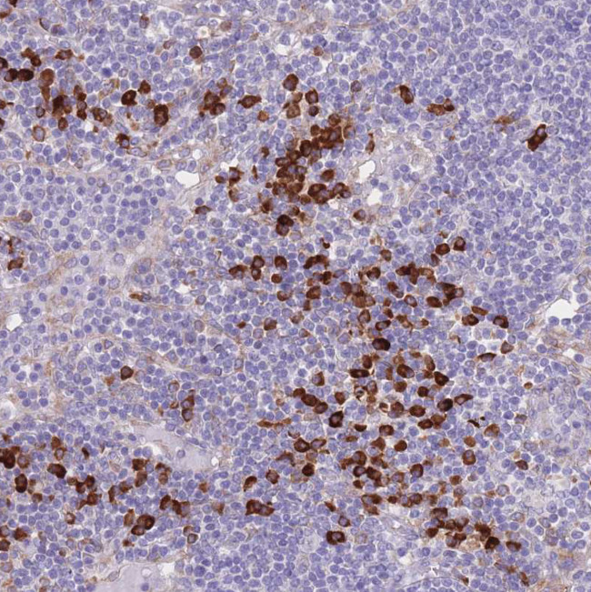 C19orf10 Antibody in Immunohistochemistry (Paraffin) (IHC (P))