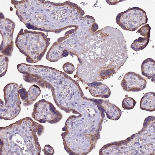 ZSWIM1 Antibody in Immunohistochemistry (Paraffin) (IHC (P))