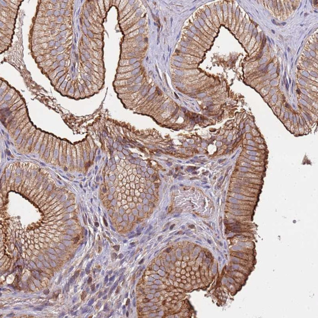 CYP2U1 Antibody in Immunohistochemistry (Paraffin) (IHC (P))