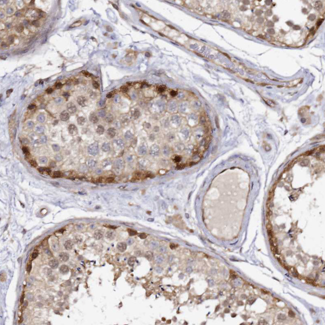 NUDT14 Antibody in Immunohistochemistry (Paraffin) (IHC (P))