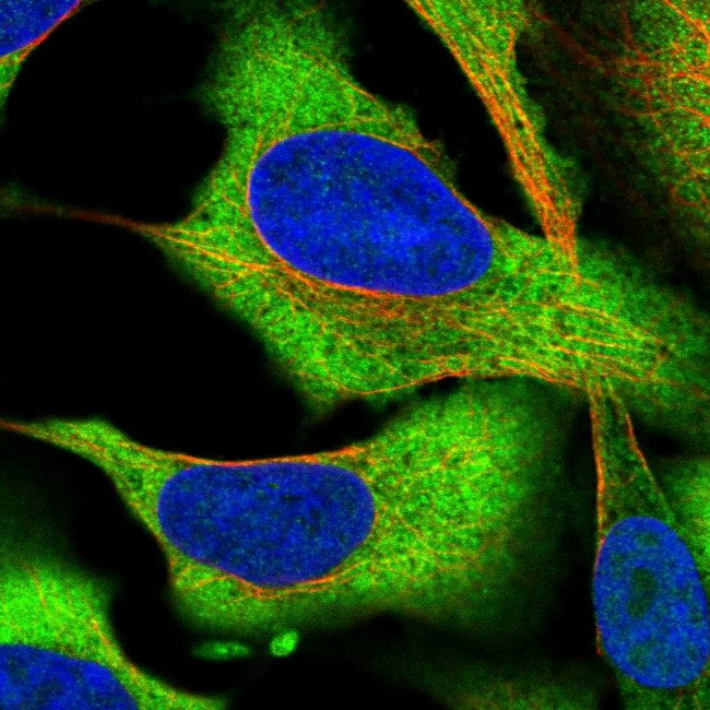 CCDC124 Antibody in Immunocytochemistry (ICC/IF)