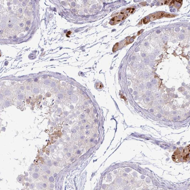 IRGC Antibody in Immunohistochemistry (IHC)