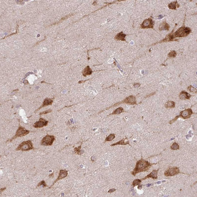 COX18 Antibody in Immunohistochemistry (Paraffin) (IHC (P))
