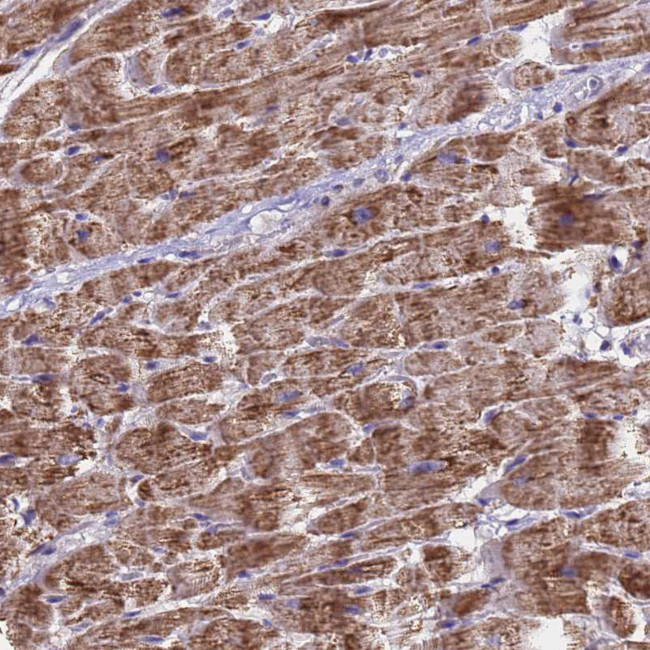 MRPS12 Antibody in Immunohistochemistry (Paraffin) (IHC (P))