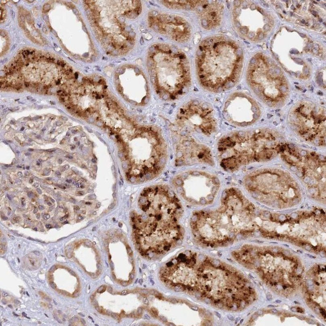 MRPL49 Antibody in Immunohistochemistry (IHC)