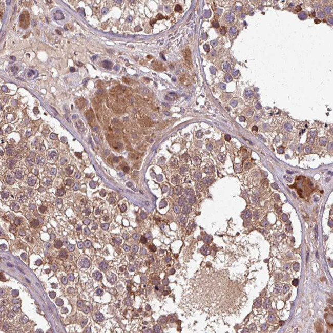 C14orf129 Antibody in Immunohistochemistry (Paraffin) (IHC (P))