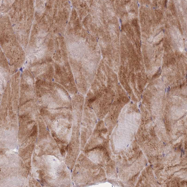 PAIP2B Antibody in Immunohistochemistry (Paraffin) (IHC (P))