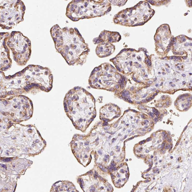PRRC2A Antibody in Immunohistochemistry (Paraffin) (IHC (P))