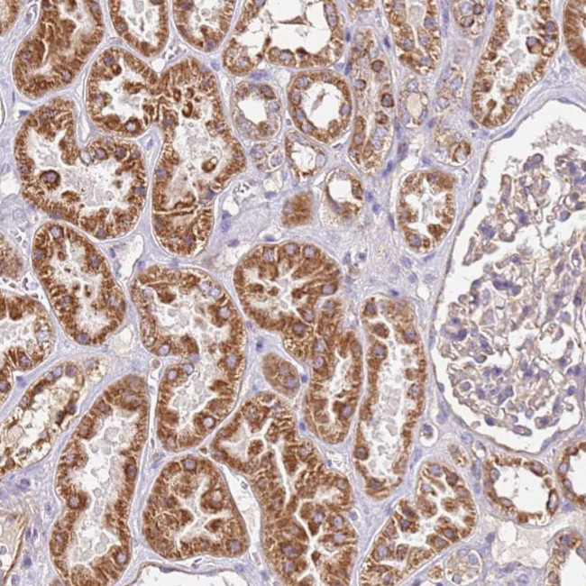 RMND5A Antibody in Immunohistochemistry (Paraffin) (IHC (P))