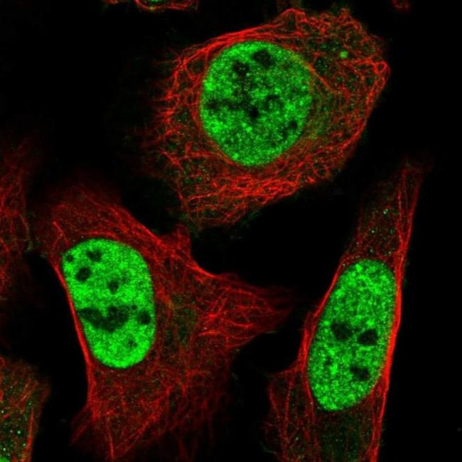 ST5 Antibody in Immunocytochemistry (ICC/IF)