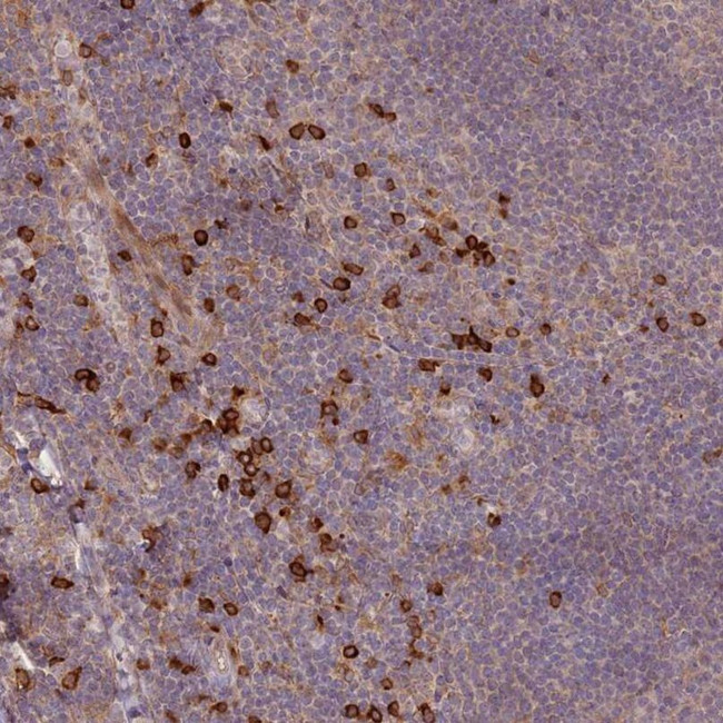 MPEG1 Antibody in Immunohistochemistry (IHC)