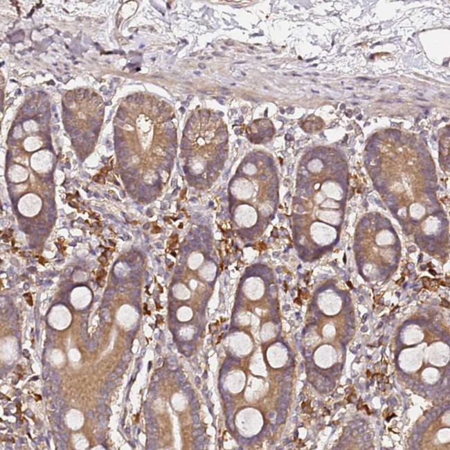 CF136 Antibody in Immunohistochemistry (Paraffin) (IHC (P))