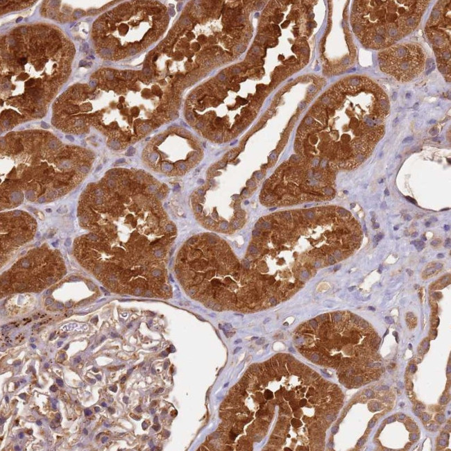 SCGB2B2 Antibody in Immunohistochemistry (Paraffin) (IHC (P))