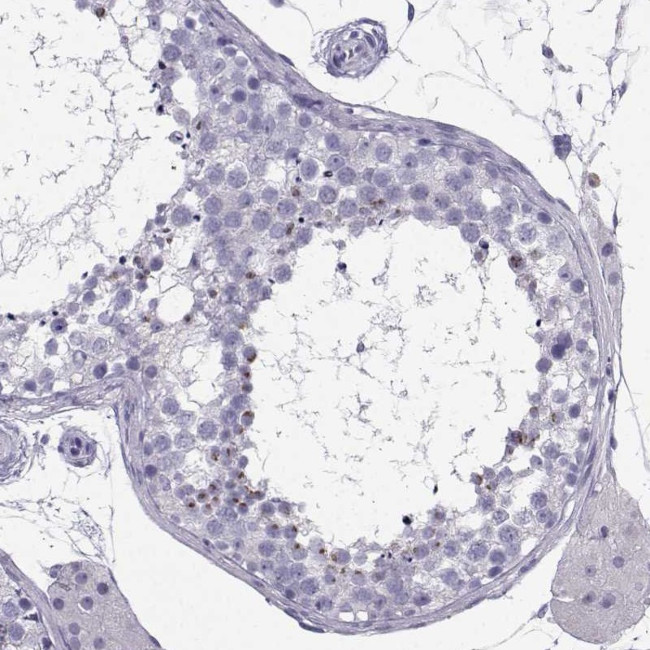 IQCD Antibody in Immunohistochemistry (IHC)
