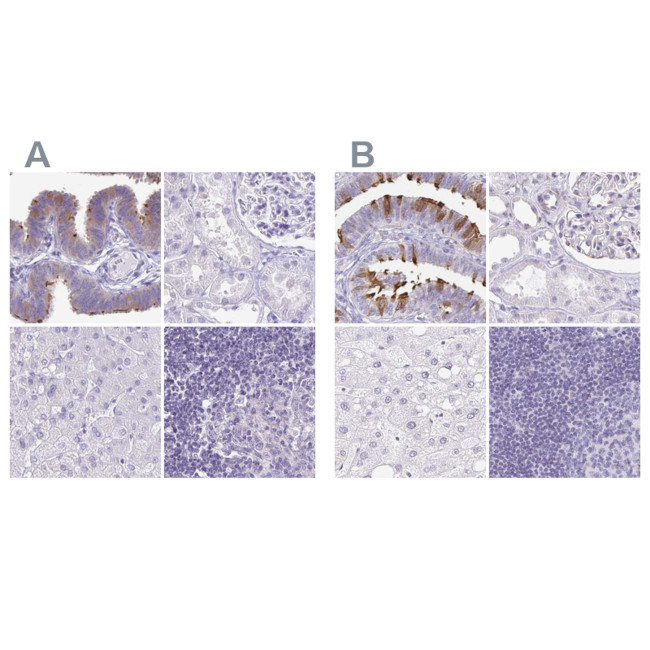CAPSL Antibody in Immunohistochemistry (IHC)