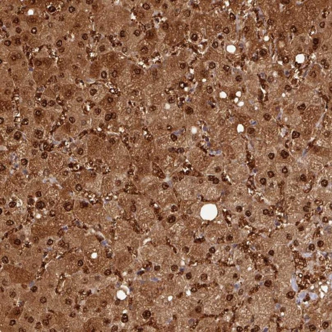 ARL17A Antibody in Immunohistochemistry (IHC)